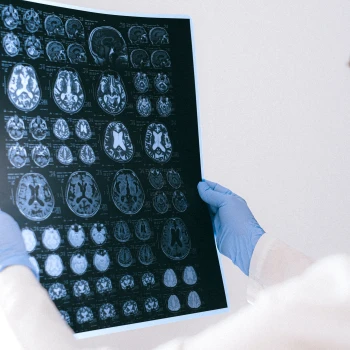 Röntgenbilder auswerten – Die Maschine weist den Radiologen auf Anomalien hin und bereitet Analyseberichte vor.