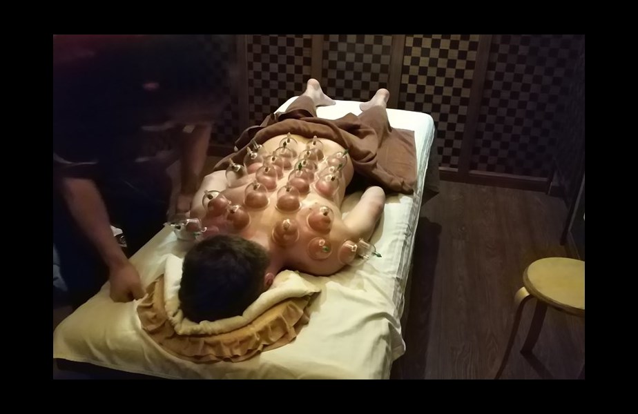 Sieht schmerzhafter aus, als es ist: Schröpfen.